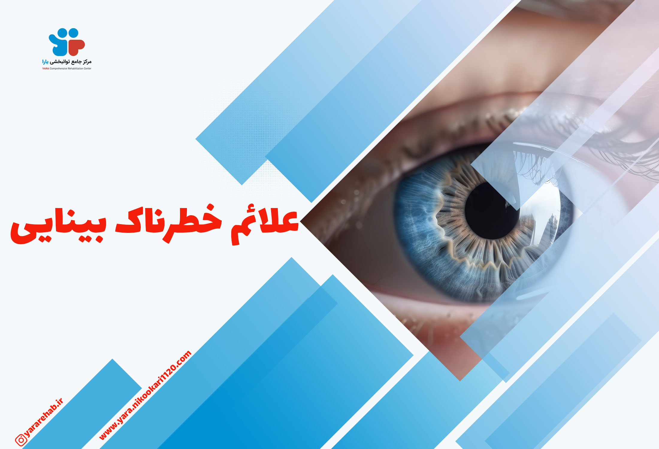 علائم خطرناک بینایی