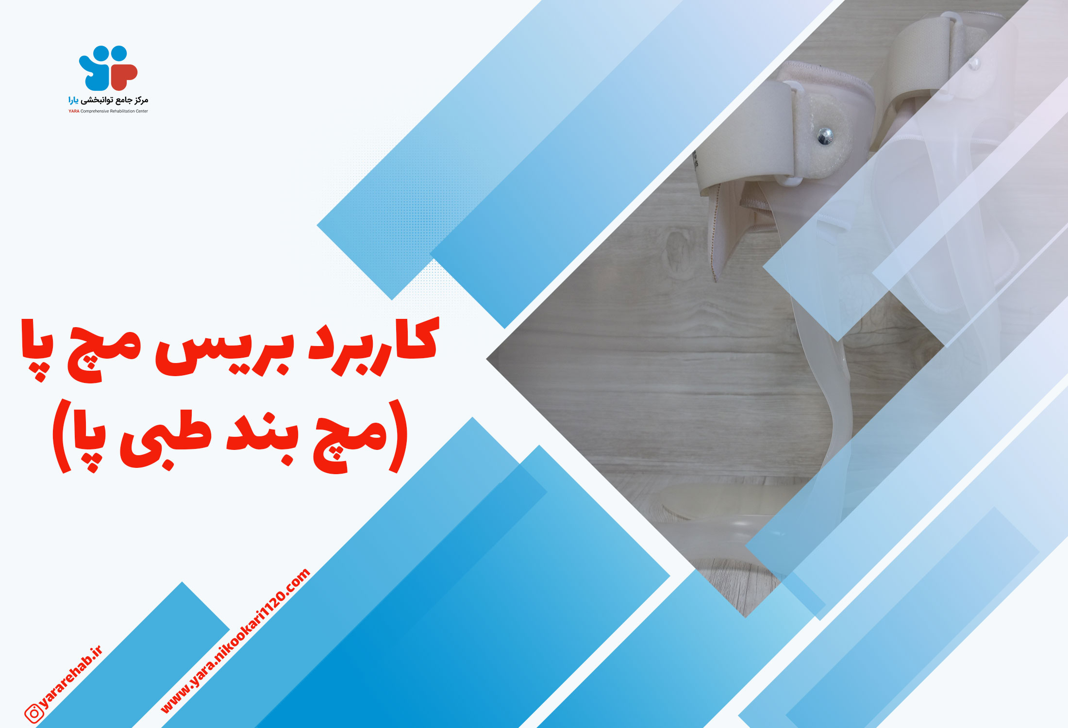 کاربرد بریس مچ پا