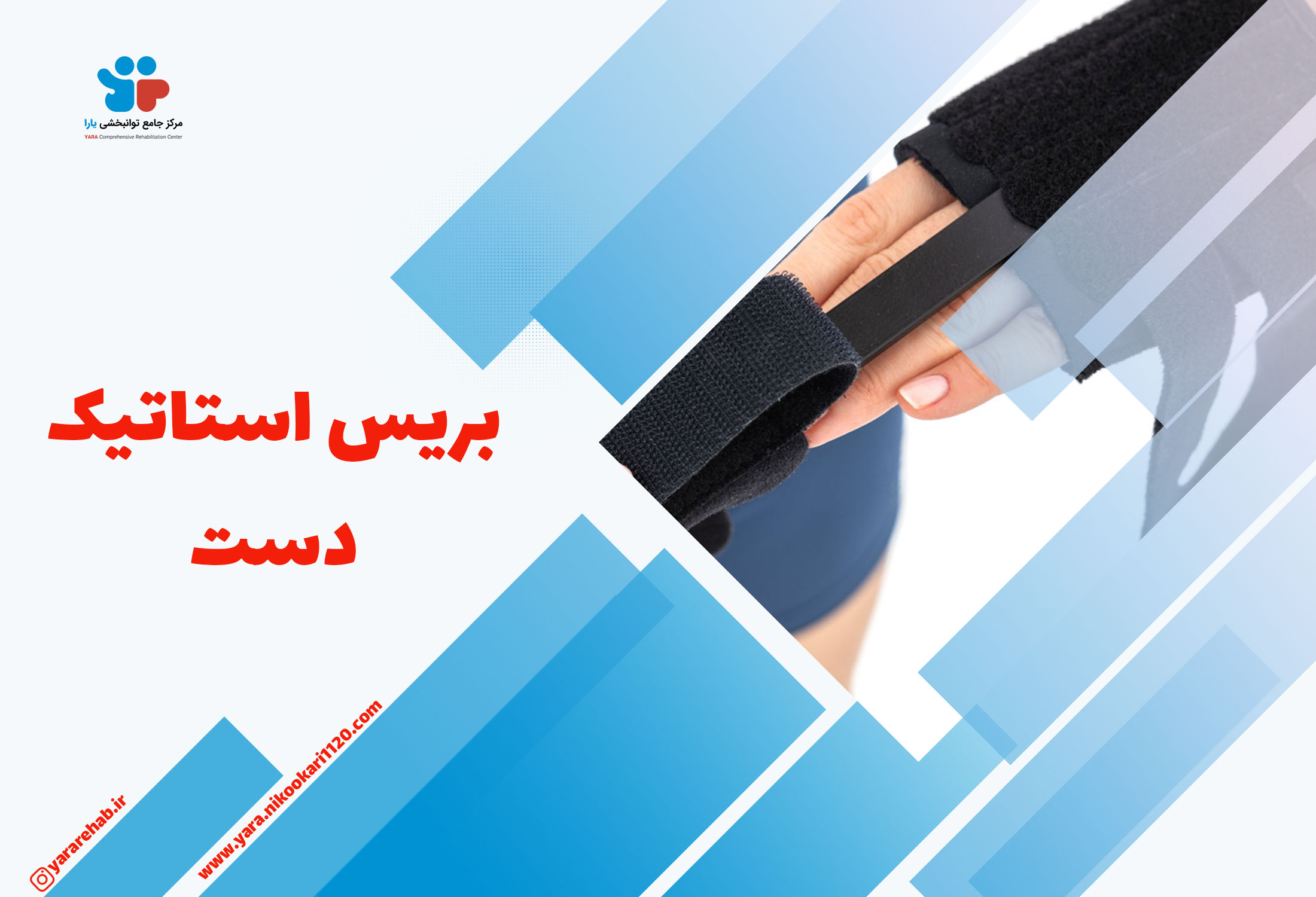 بریس استاتیک دست