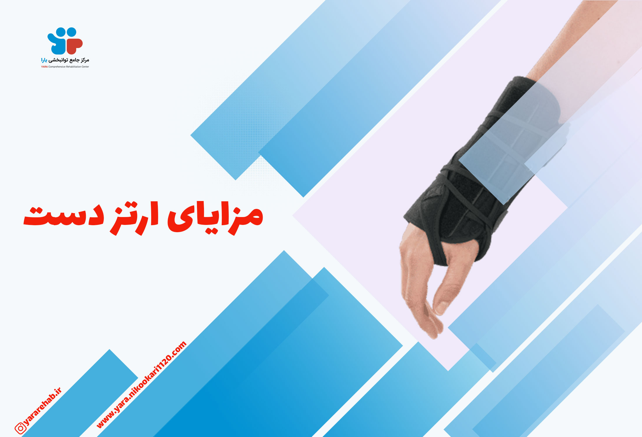 مزایای ارتزدست