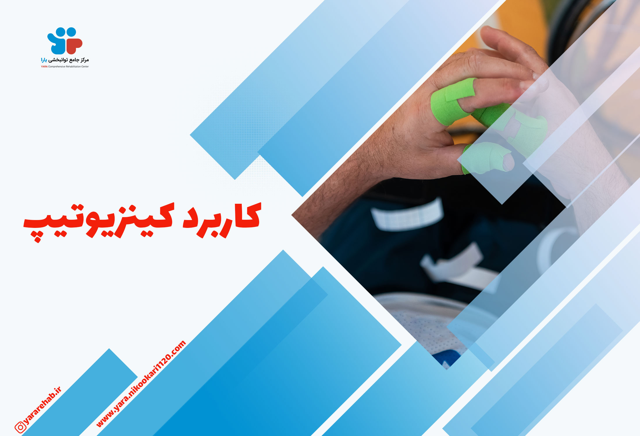 کاربرد کینزیوتیپ